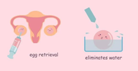 借卵宝宝湿疹，如何选择合适的药膏进行缓解