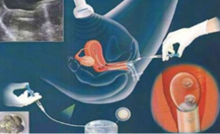 借卵宝宝积食的快速消除方法